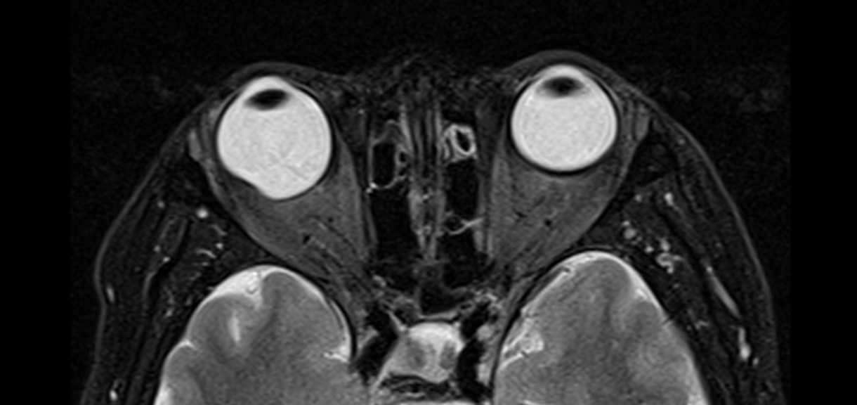 Resonancia Magnética de Órbita