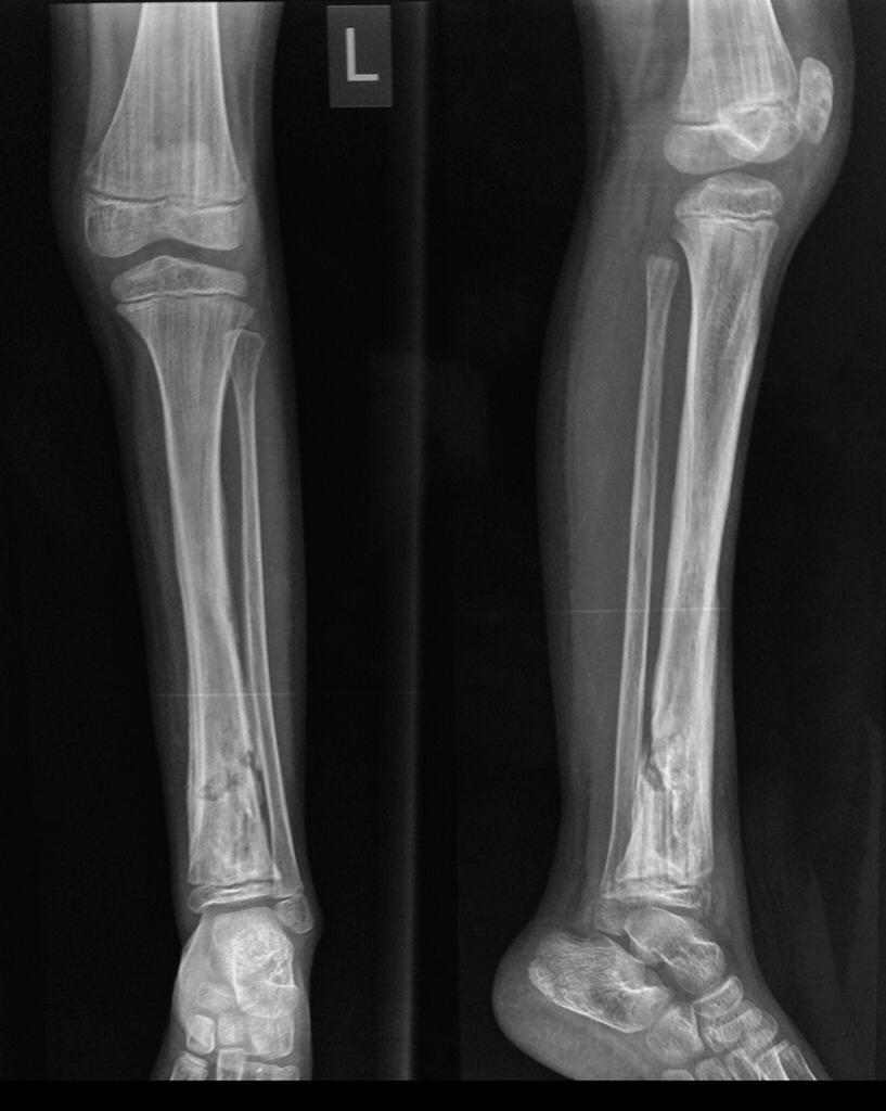 Radiografía  Simple